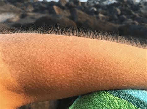 Everything You Need To Know About Goosebumps Meaning