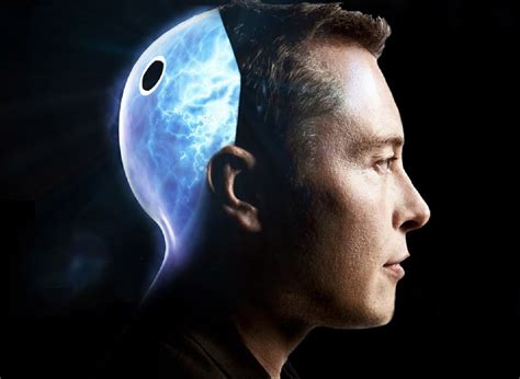 Elon Musk Says He Could Have A Neuralink Brain Implant In Right Now