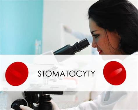 Stomatocyty Okiem Diagnosty