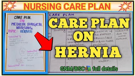 Download Care Plan On Hernia। Hernia। Nursing Care Plan On Hernia