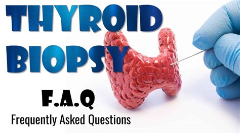 62 Frequently Asked Question On Thyroid Biopsy Youtube