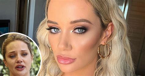 Exclusive Jessika Power Opens Up About Her Shocking Botched Plastic Surgery And Debilitating