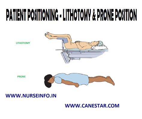PATIENT POSITIONING LITHOTOMY PRONE POSITION Nurse Info