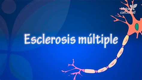 La esclerosis múltiple es una enfermedad crónica que ataca al sistema nervioso central (el cerebro y la espina dorsal). Qué es la esclerosis múltiple - YouTube Mundo | Esclerosis ...