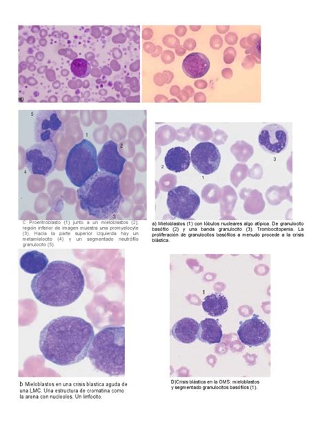 Mieloblasto Leucocito Citoplasma