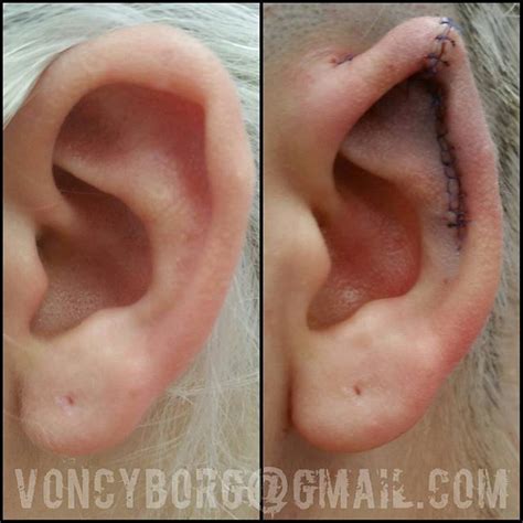 Samppa von cyborg is a body modification ar. Pin by Inga on body mods | Body mods, Pixie ears, Pointed ears