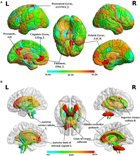 Frontiers Brain Differences Between Men And Women Evidence From Deep Learning