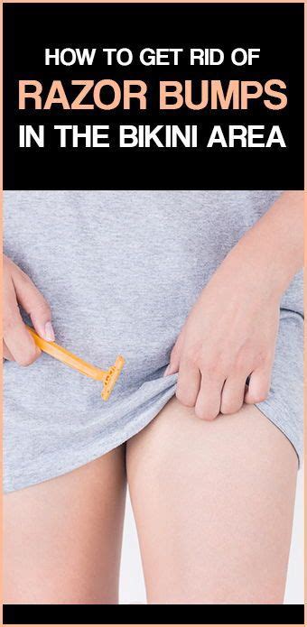 This next one will be very painful to read about, but it is something that is necessary. How to Get Rid of Razor Bumps In The Bikini Area? | Razor ...