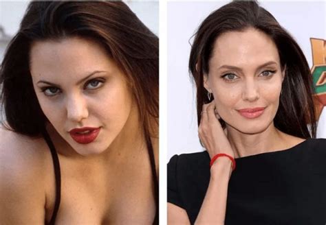 Before And After Plastic Surgery Stunning Transformations