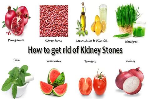 25 Easy Natural Remedies For Kidney Stones That Can Help Flush It Out