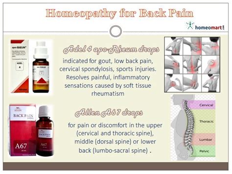 Soft Tissue Rheumatism And Homeopathy Medicines Homeopathy