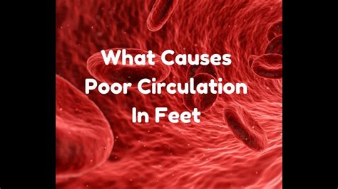 What Causes Poor Circulation In Feet Youtube