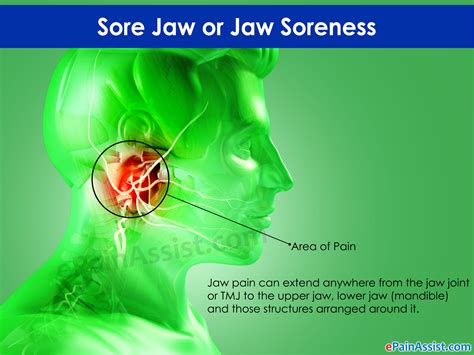 Sore Jaw Or Jaw Sorenesstreatmentcausessymptoms