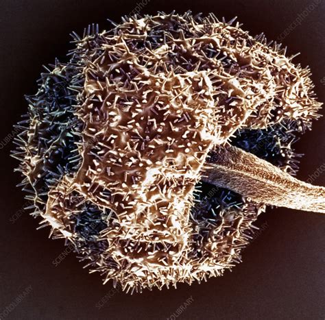 Fungal Sporangium Sem Stock Image B2500997 Science Photo Library