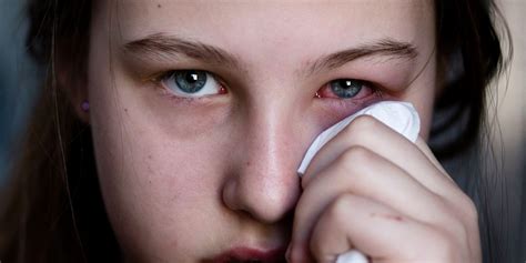 Why Is Pink Eye More Common During Cold And Flu Season Baptist Eye