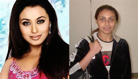 Bollywood Actresses Shocking Photos Before And After Plastic Surgery Style Hunt World