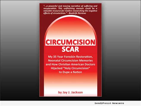 New Book Circumcision Scar Is A Memoir Revealing How The Worlds