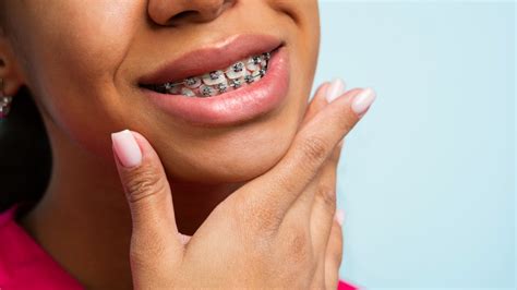 How Much Do Braces Actually Cost These Days Trendradars