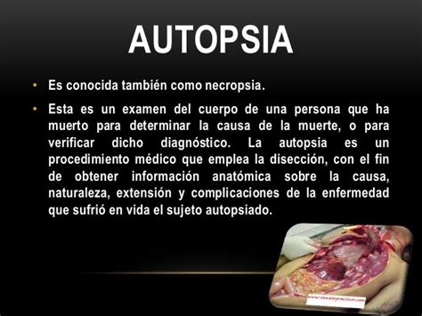 Autopsia Y Necropsia Significado Kulturaupice