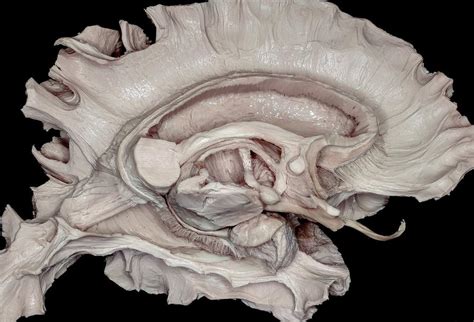 Midsagittal Perspective Of Deep Cerebral Anatomy Neuroanatomy The