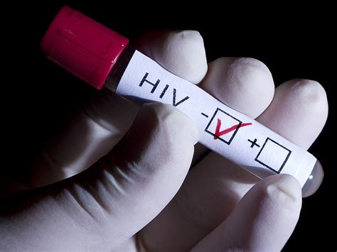 New Considerations In Hiv Care Diagnostics