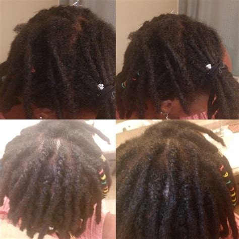 My Hair Grows Away From My Locs I Really Dont Like To Retwist