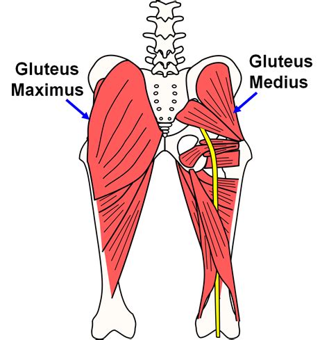 Gluteus Medius Pain