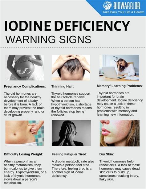Iodine Deficiency Warning Signs Iodine Deficiency Iodine Deficiency