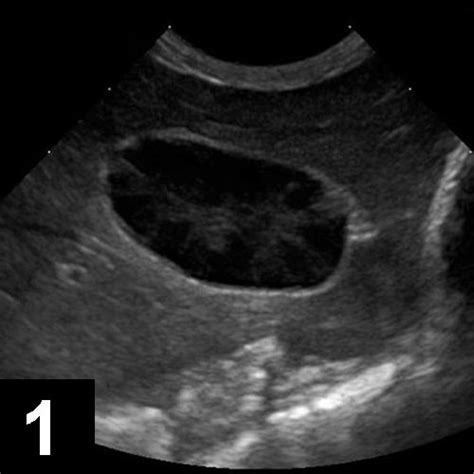 Gallbladder Mucocele In Dogs Clinicians Brief