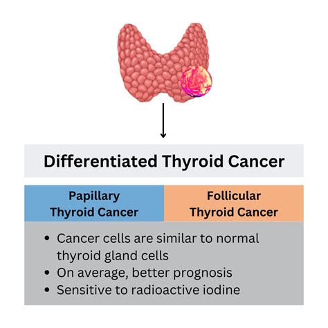 What Does It Mean To Have “differentiated Thyroid Cancer” Qualisure