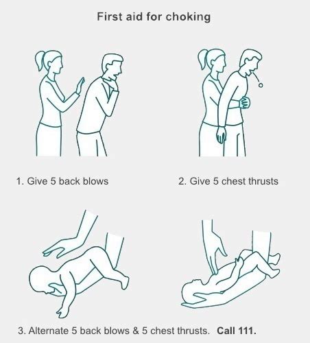 If they prepare you with specific instructions. Choking