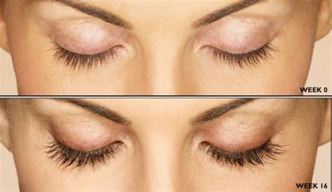 Insurance probably won't cover latisse unless you have a medical condition that affects your eyelashes. Latisse - Grows Eyelashes Longer, Fuller and Darker