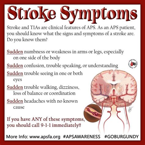 18 Best Images About Stroke And Tia Information On Pinterest Lost What