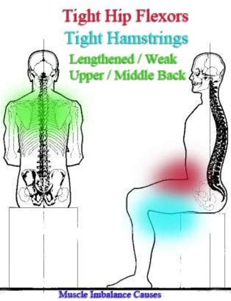 Seated Posture Problems Excellent Article On Postural Imbalance