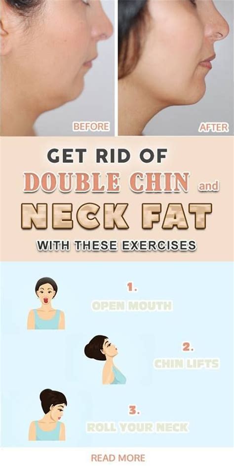 How To Get Rid Of Double Chin Workout Workoutwalls