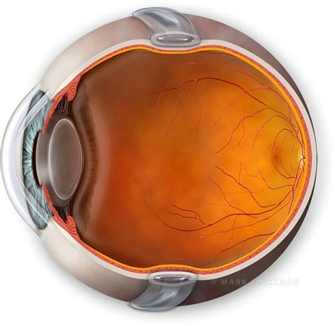 Scleral Buckle Retinal Detachment Treatment Cross Section Eye Illustration