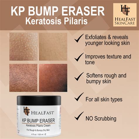 Kp Bump Eraser Cream
