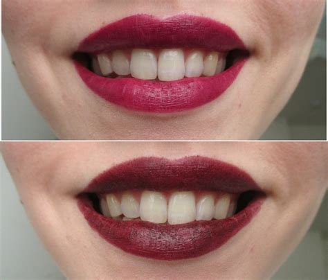 What Color Lipstick Makes Teeth Look Whiter A Handy Guide To Getting
