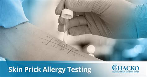 Skin Prick Allergy Testing In Atlanta Chacko Allergy