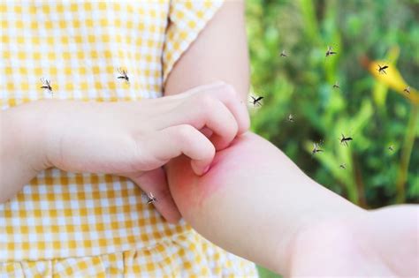 Premium Photo Little Girl Has Skin Rash Allergy And Itchy On Her Arm