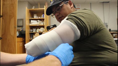 Mercer University Building Prosthetic For Man With Stump Arm By