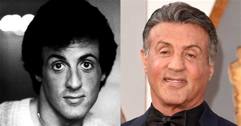 Sylvester Stallone Plastic Surgery Disasters Purple Clover