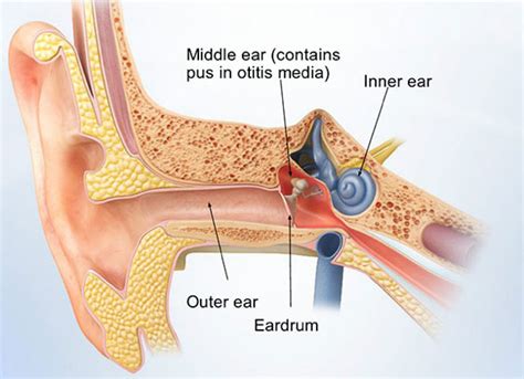 Otitis Externa Swimmers Ear