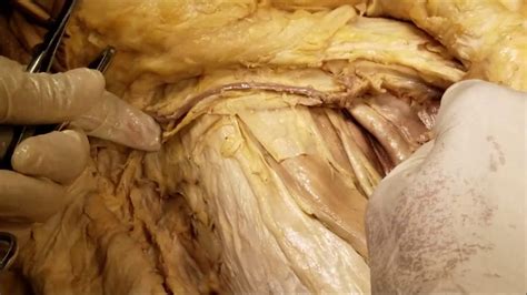 Contents of the femoral canal. Femoral Triangle Adductor Canal Nerve-Vessels - Femoral ...