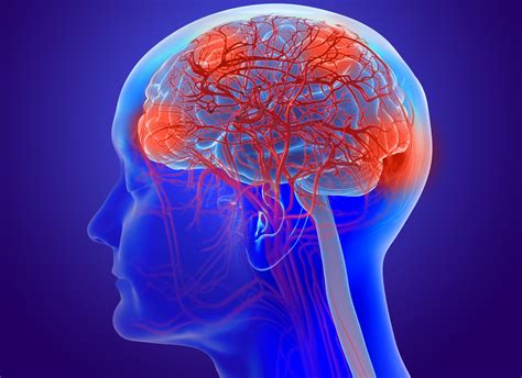 Small Blood Vessel Disease In The Brain Linked To Worse Cognition In