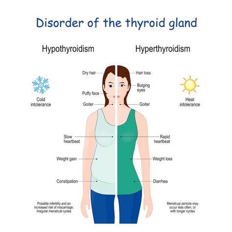 What Is The Main Cause Of Thyroid Disease 27f Chilean Way