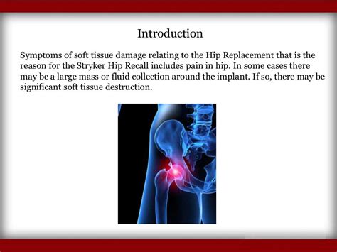 Symptoms Of Hip Replacement Implant Recall