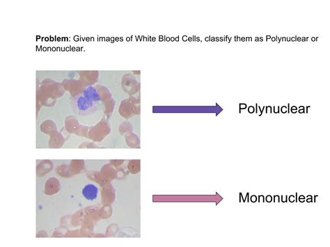 Using Deep Learning To Classify White Blood Cells Code Data Included