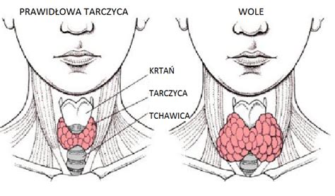 Niedoczynno Tarczycy Przyczyny Objawy Leczenie Naturalne Suplementy Witaminy I Zio A