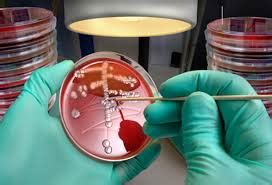 Listeria Infection Listeriosis Symptoms Causes Treatment